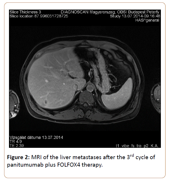 oncopathology-clinical-research-panitumumab