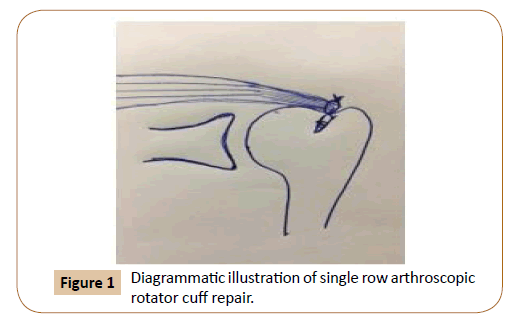 orthopaedic-disorders-arthroscopic