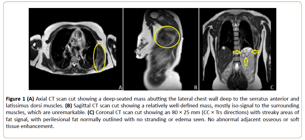 orthopaedic-disorders-mass