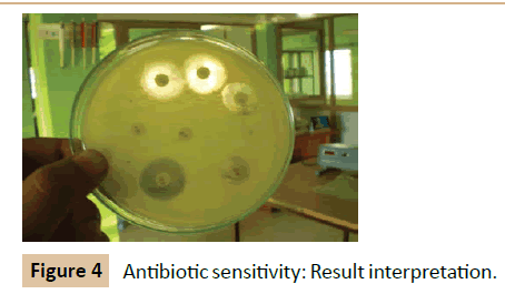 pharmaceutical-biotechnology-Antibiotic-sensitivity