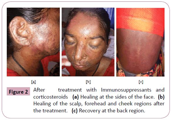 pharmacology-pharmacotherapeutics-Immunosuppressants