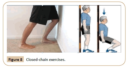 physiotherapy-research-Closed-chain