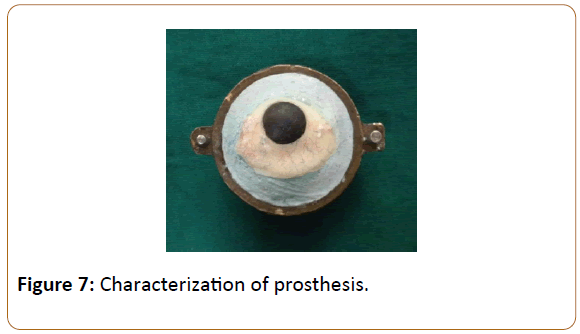 prosthetics-and-orthotics-open-journal-Characterization