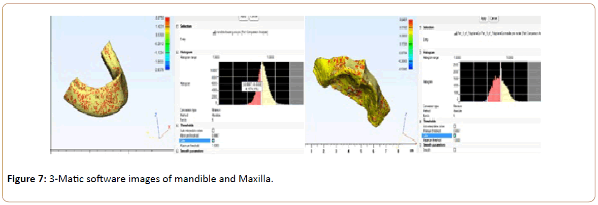 prosthetics-and-orthotics-open-journal-Matic-software