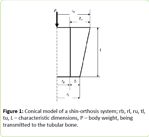 The Role Of Orthotics In Diabetic Feet A Surgeonaƒa A A A A S Perspective Experts Comments Insight Medical Publishing