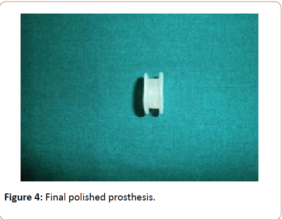 prosthetics-orthotics-open-journal-Final-polished
