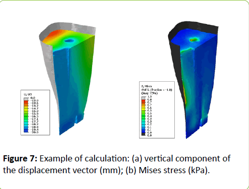 prosthetics-orthotics-open-journal-Mises-stress