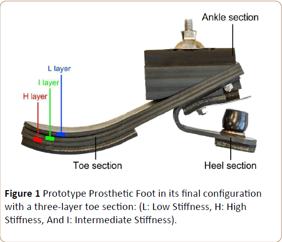 prosthetics-orthotics-open-journal-Prototype-Prosthetic