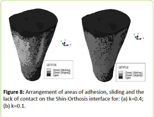 prosthetics-orthotics-open-journal-Shin-Orthosis