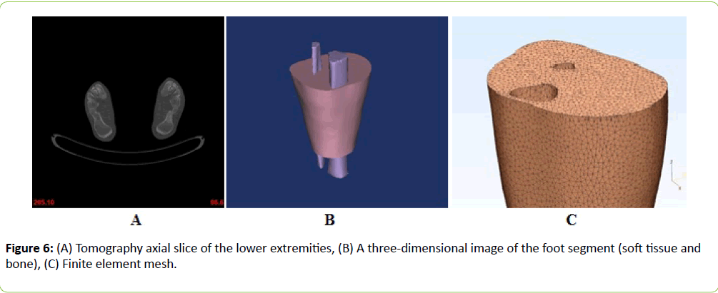 prosthetics-orthotics-open-journal-axial-slice