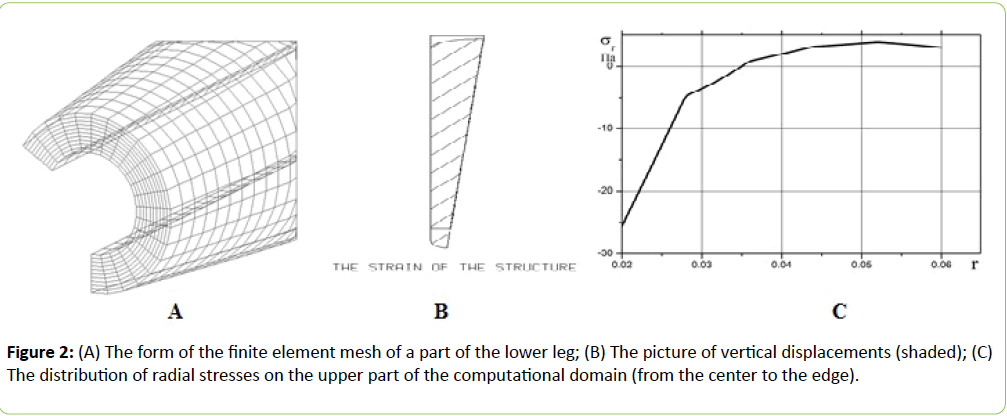 prosthetics-orthotics-open-journal-finite-element