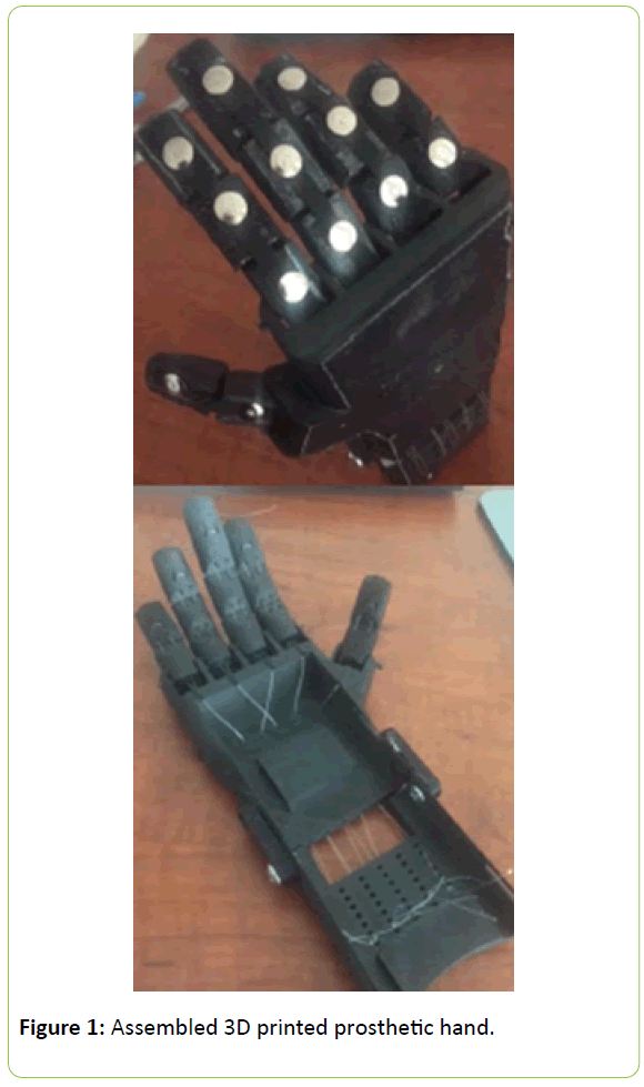 prosthetics-orthotics-printed-prosthetic-hand