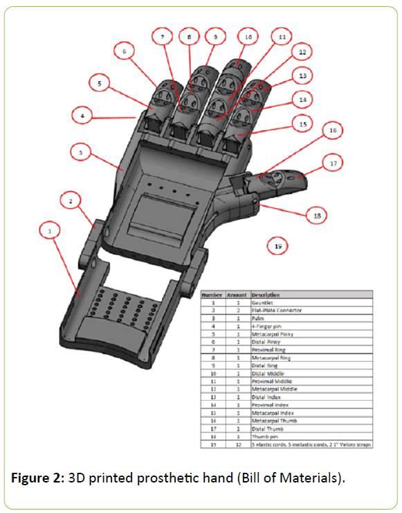 prosthetics-orthotics-printed-prosthetic-hand