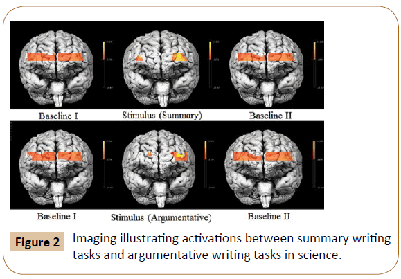 psychology-and-brain-studies-Imaging-illustrating