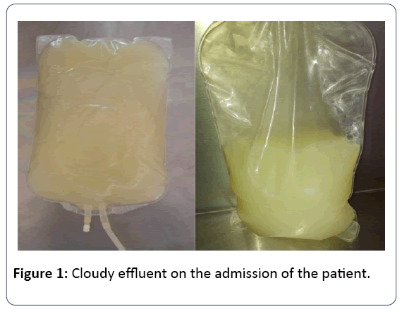 renal-medicine-Cloudy-effluent