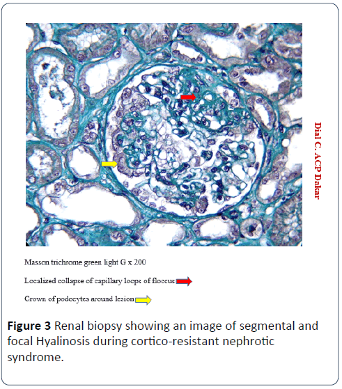 renal-medicine-Renal-biopsy