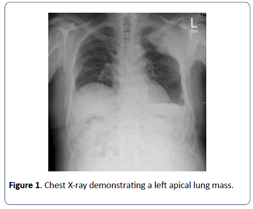 renal-medicine-apical-lung