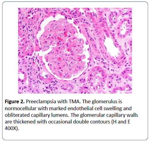 renal-medicine-endothelial