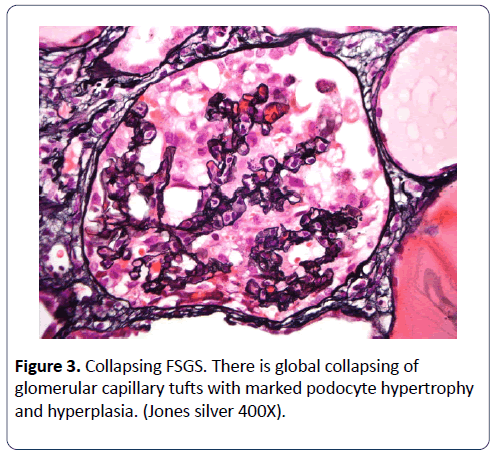 renal-medicine-glomerular