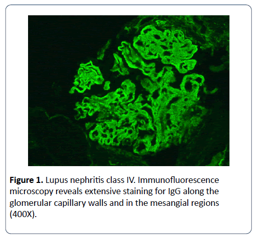 renal-medicine-nephritis