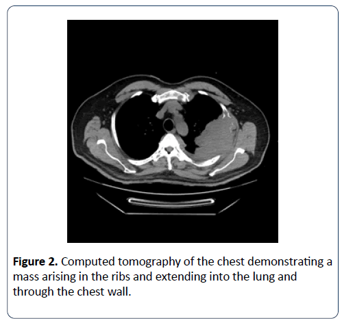 renal-medicine-tomography