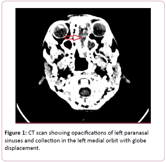 research-journal-of-ear-nose-andthroat-CT-scan