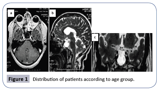 research-journal-of-nervous-system-patients