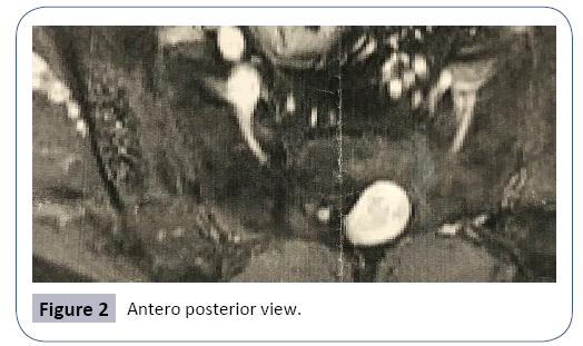 research-journal-of-nervous-system-posterior