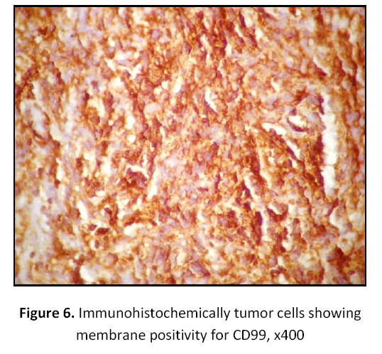 research-review-maternal-Immunohistochemically