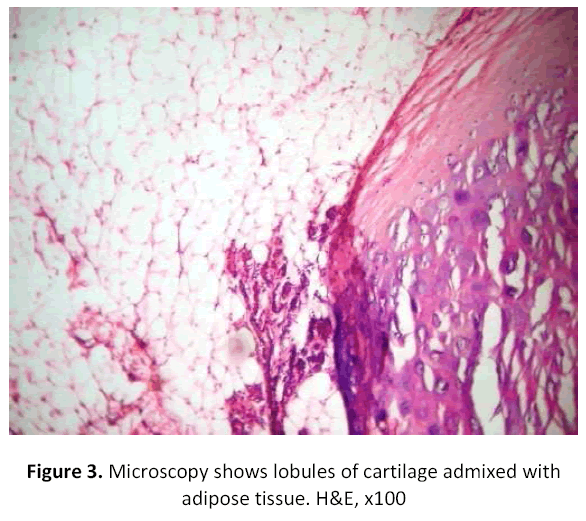 research-review-maternal-cartilage