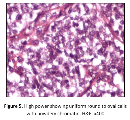 research-review-maternal-chromatin