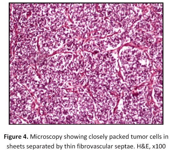 research-review-maternal-fibrovascular