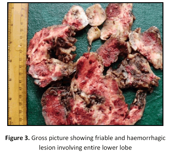 research-review-maternal-haemorrhagic