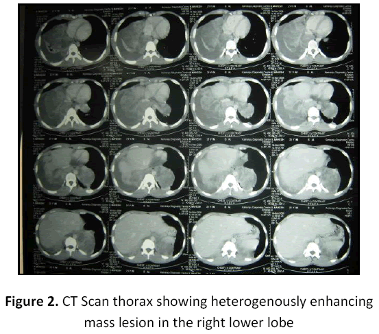 research-review-maternal-heterogenously