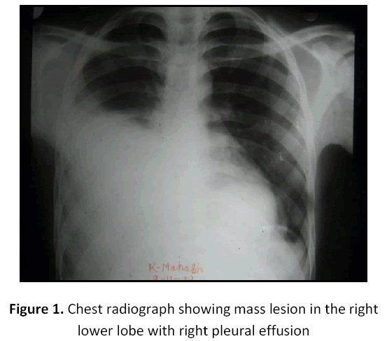 research-review-maternal-radiograph