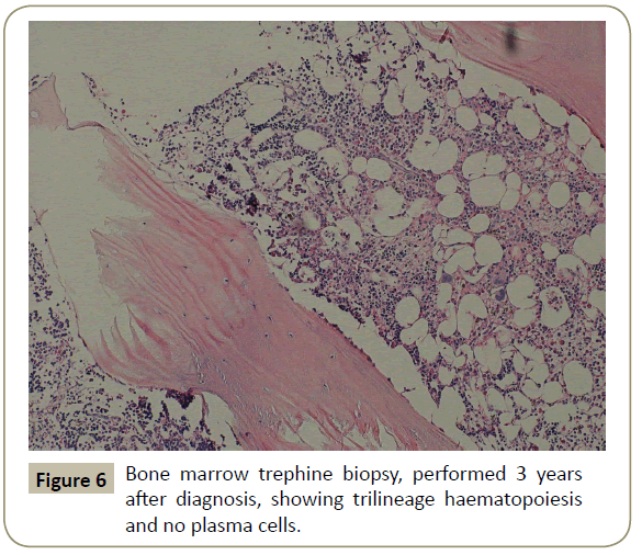 stem-cell-biology-Bone-marrow