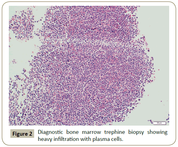 stem-cell-biology-Diagnostic-bone