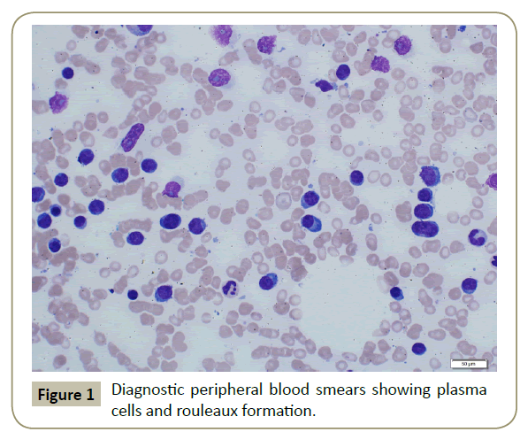 stem-cell-biology-Diagnostic-peripheral