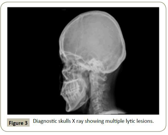 stem-cell-biology-Diagnostic-skulls