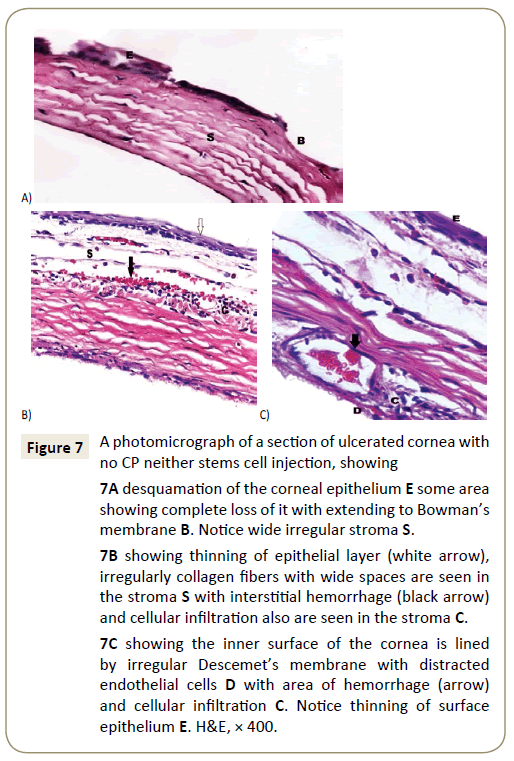 stem-cell-biology-and-transplantation-epithelium