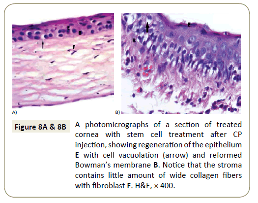 stem-cell-biology-and-transplantation-epithelium