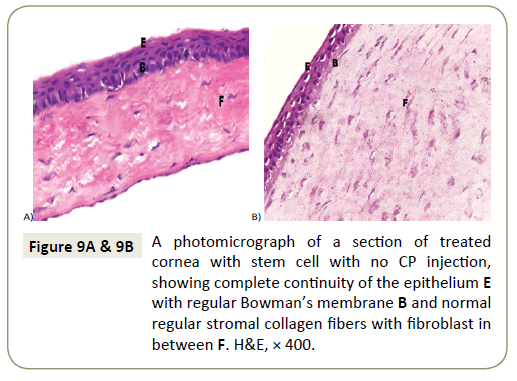 stem-cell-biology-and-transplantation-fibers