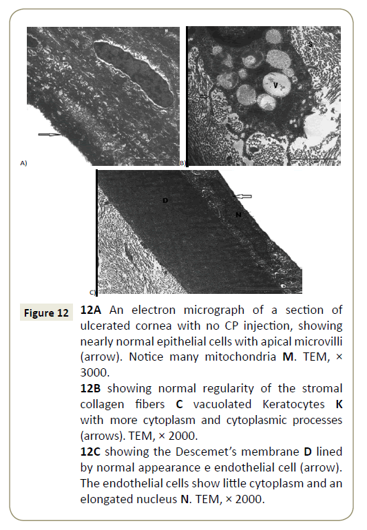 stem-cell-biology-and-transplantation-microvilli