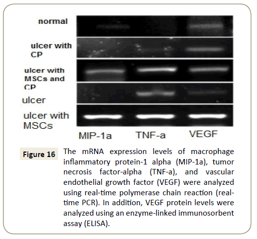 stem-cell-biology-and-transplantation-vascular