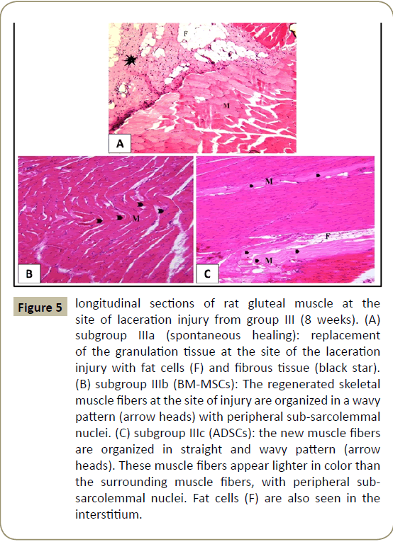 stem-cell-biology-transplantation-Fat-cells