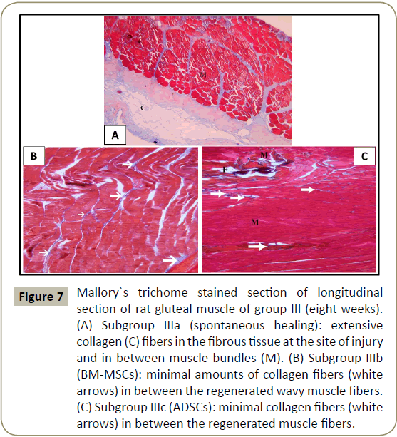 stem-cell-biology-transplantation-muscle-fibers