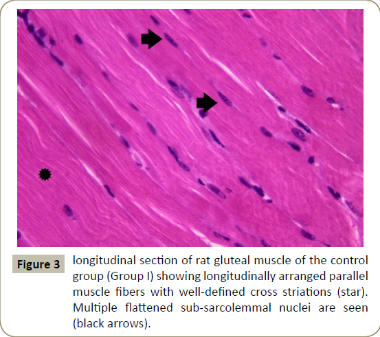 stem-cell-biology-transplantation-sub-sarcolemmal