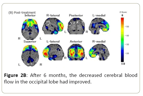 surgery-and-emergency-medicine-cerebral