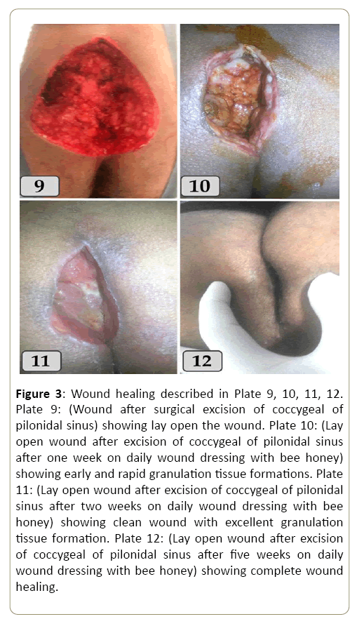 surgery-and-emergency-medicine-coccygeal