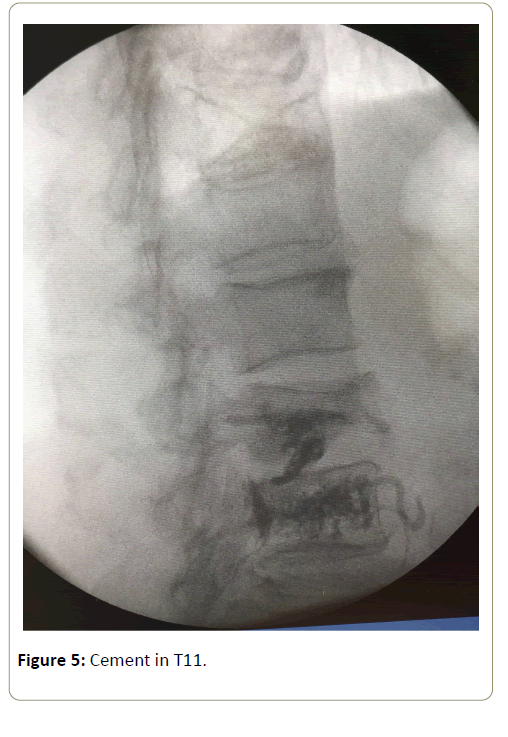 surgery-emergency-medicine-cement